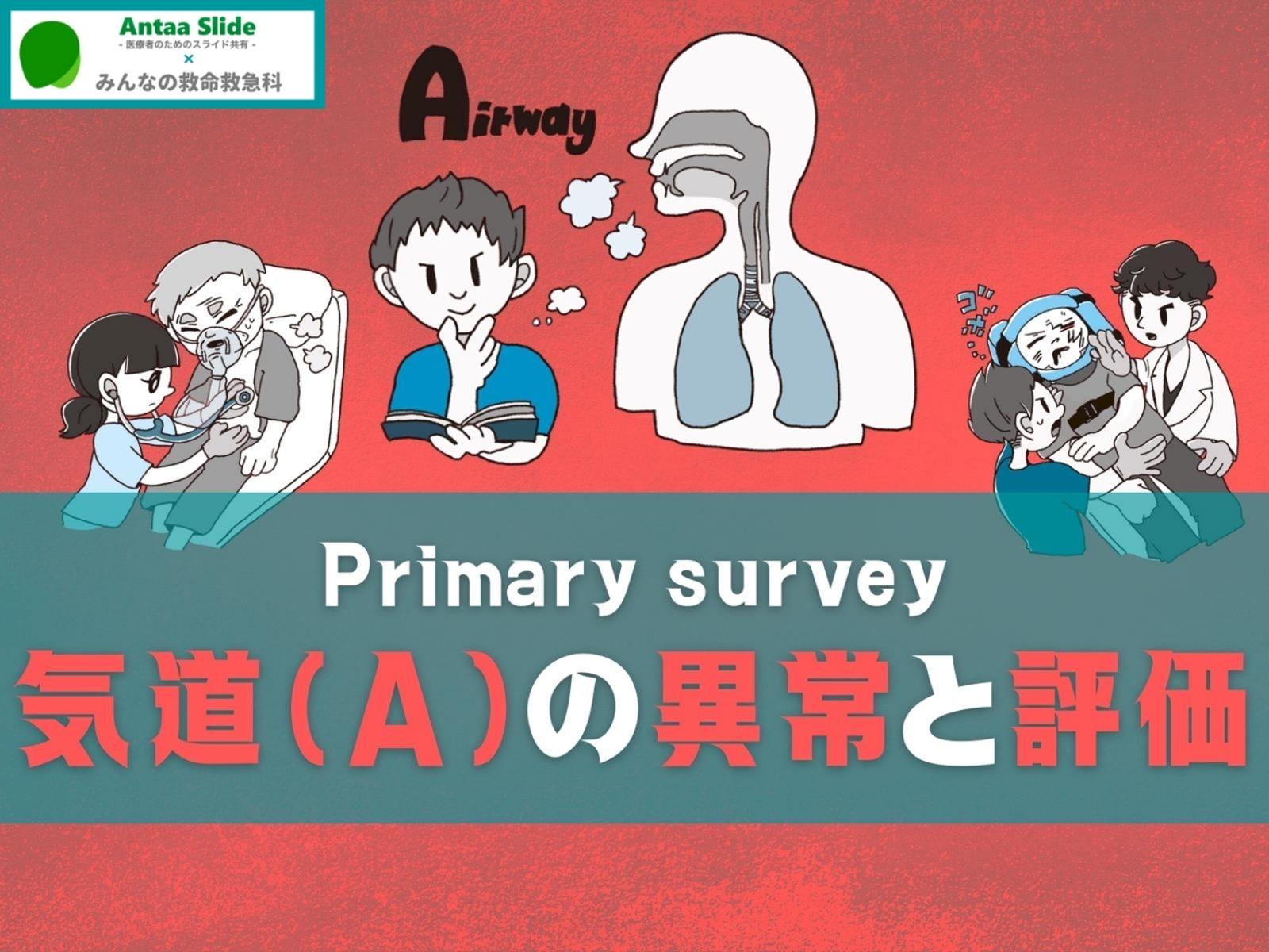 10分で理解できる】Primary Survey 気道(A)の異常【解剖・気道確保を 
