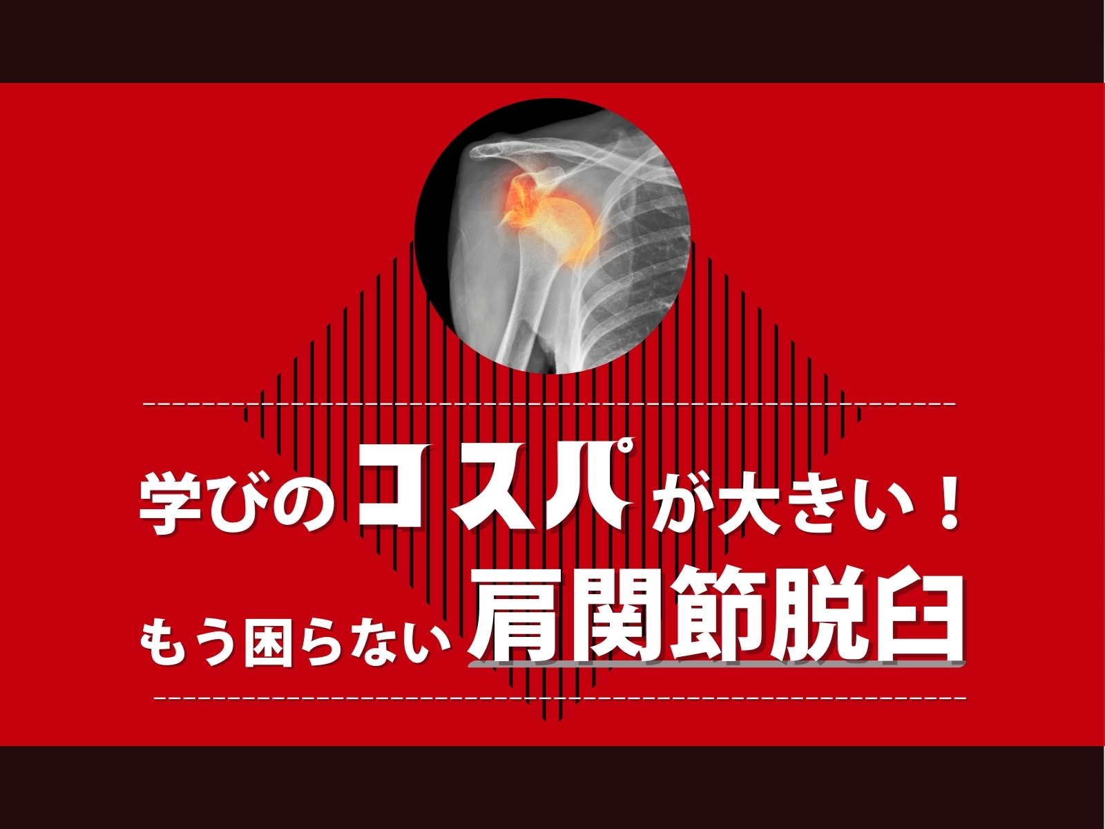 肩関節外科の要点と盲点　裁断済み 肩関節外科の要点と盲点 裁断済み 肩関節外科の要点と盲点
